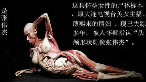 这个人体标本被怀疑是被失踪的张伟杰制成的。(网络图片)