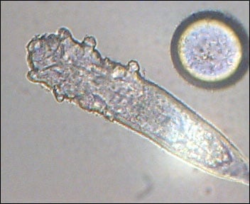�������棨Demodex�������ë�����桢ë�ҳ档 �༭:twyishin 2026-07-11 16:16 ͼƬ��Դ�� ���ͼƬ ��ͼƬ��Դ��Haarbalgmilbe im Durchlichtmikroskop��ά���ٿƣ�
